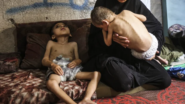 14 people die from malnutrition in Gaza, health ministry says