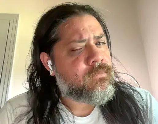 Two men arrested, charged with second-degree battery after alleged hate attack in Lafayette