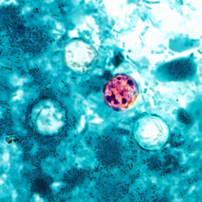 Consumption of fresh produce tainted with parasite linked to over 20 cases of intestinal illness in Louisiana